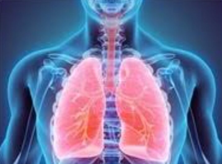 COPD നിസാരമായി കാണരുത് ഈ അസുഖം. ഇതിൻ്റെ ആരോഗ്യ പ്രശ്നങ്ങൾ എന്തൊക്കെയാണെന്ന് ഡോക്ടർ വിശദീകരിക്കുന്നു